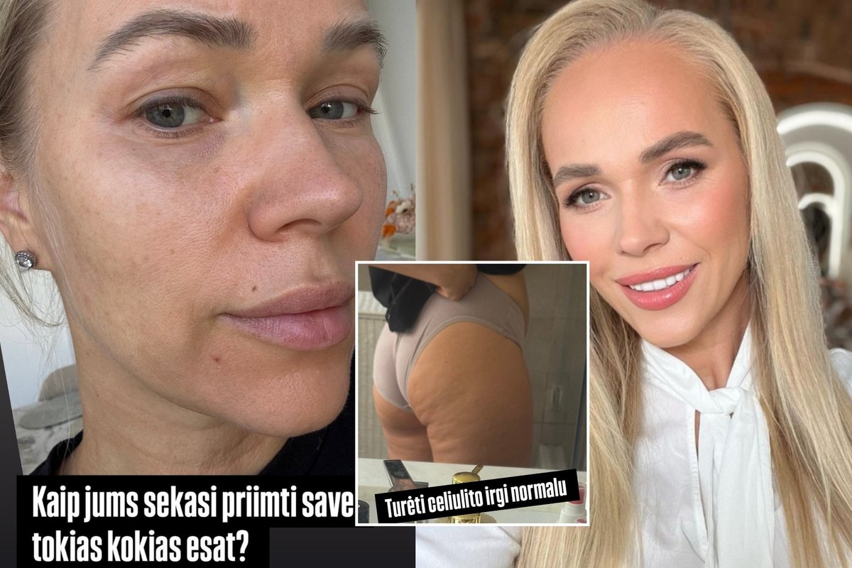 Socialinių tinklų žvaigždė Ieva Voveris parodė nepagražintą realybę