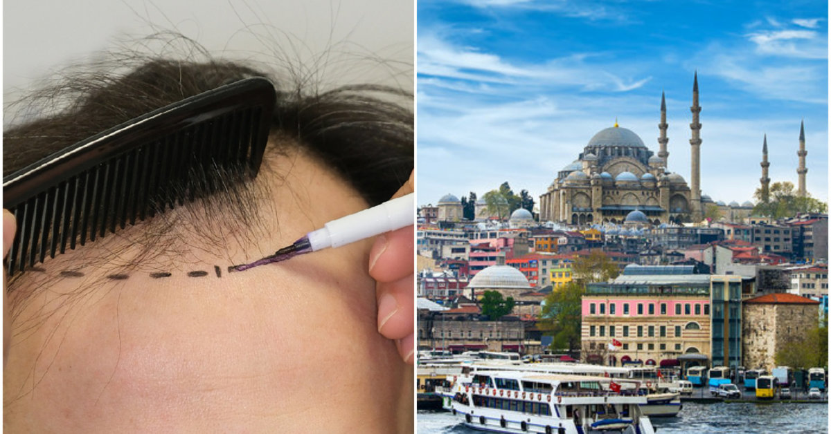 Tragiška grožio kelionė: į Turkiją 36-erių vyras vyko dėl plaukų ir dantų, grįžo – karste | Gyvenimas