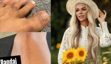 Ieva Voveris parodė netobulą kūną – atsivėrė apie tai, ką ilgai slėpė