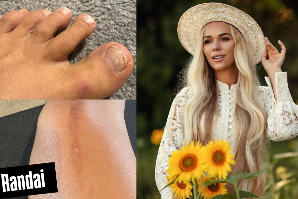 Ieva Voveris parodė netobulą kūną – atsivėrė apie tai, ką ilgai slėpė