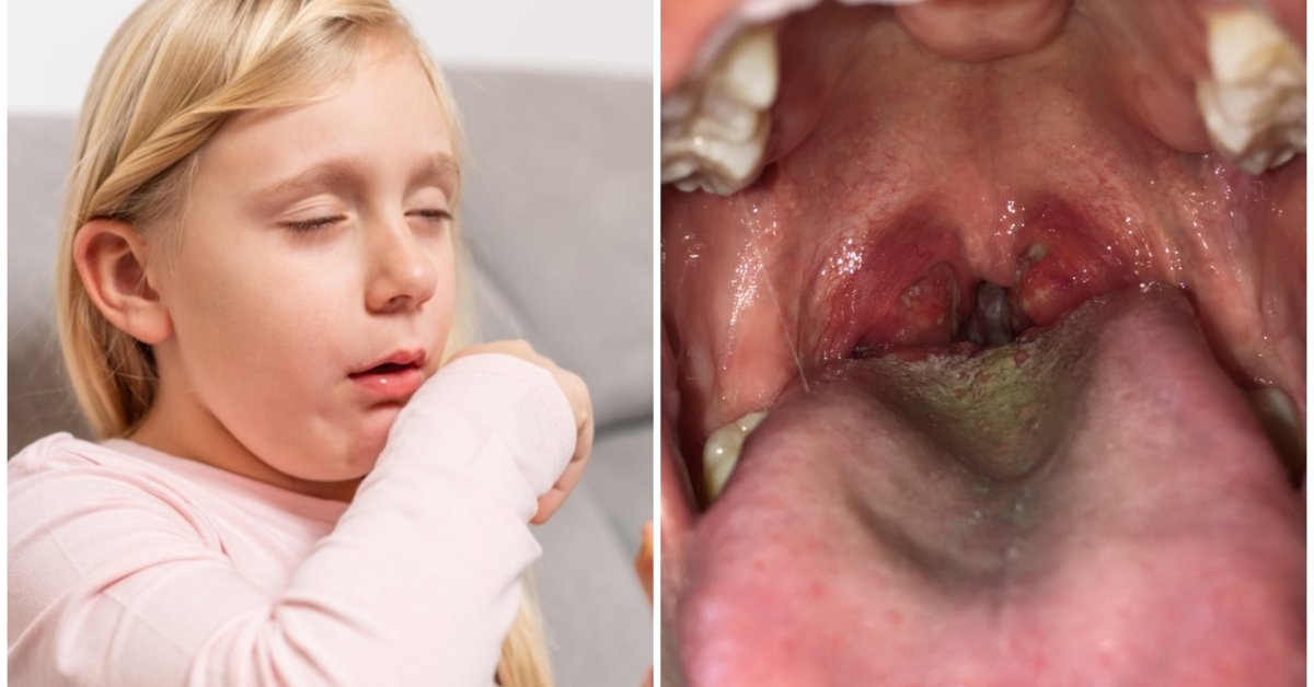 Ar difterija vėl beldžiasi į mūsų šalį: gydytojai atviri – kalti ne tik migrantai