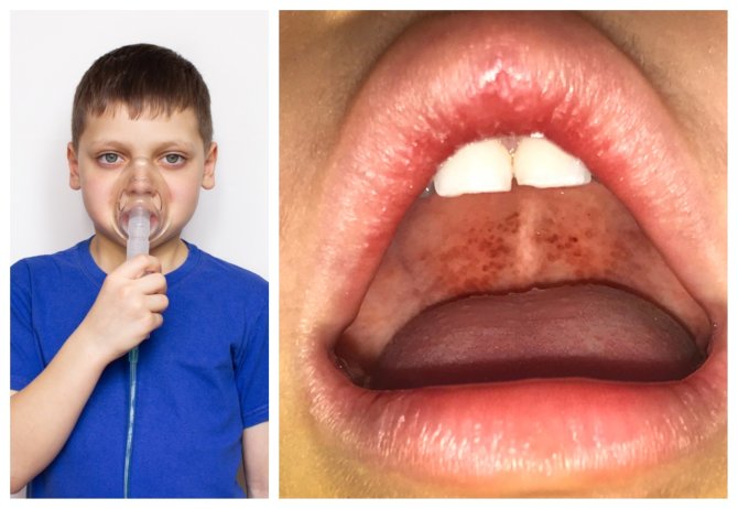 Shutterstock nuotr./Difterija sugrįžo ir kelia pavojų ne tik vaikams