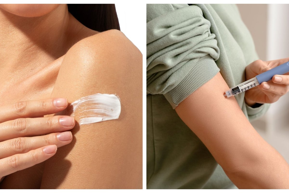 Proveržis diabeto srityje: insulino injekcijas pakeis kremas