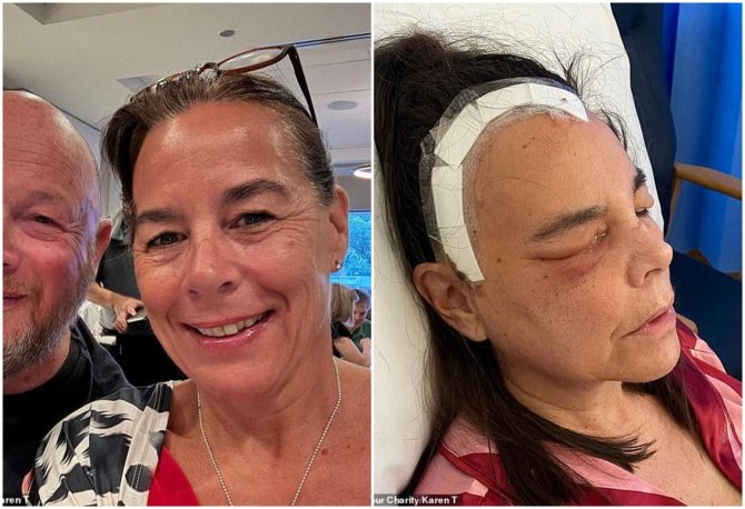 The Brain Tumour Charity nuotr./Karen su vyru ir po operacijos