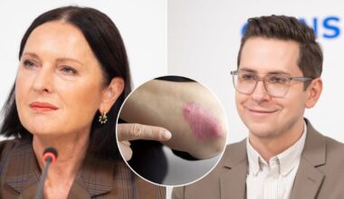 Už mažo bėrimo gali slypėti didelė bėda – padidina net infarkto, diabeto riziką