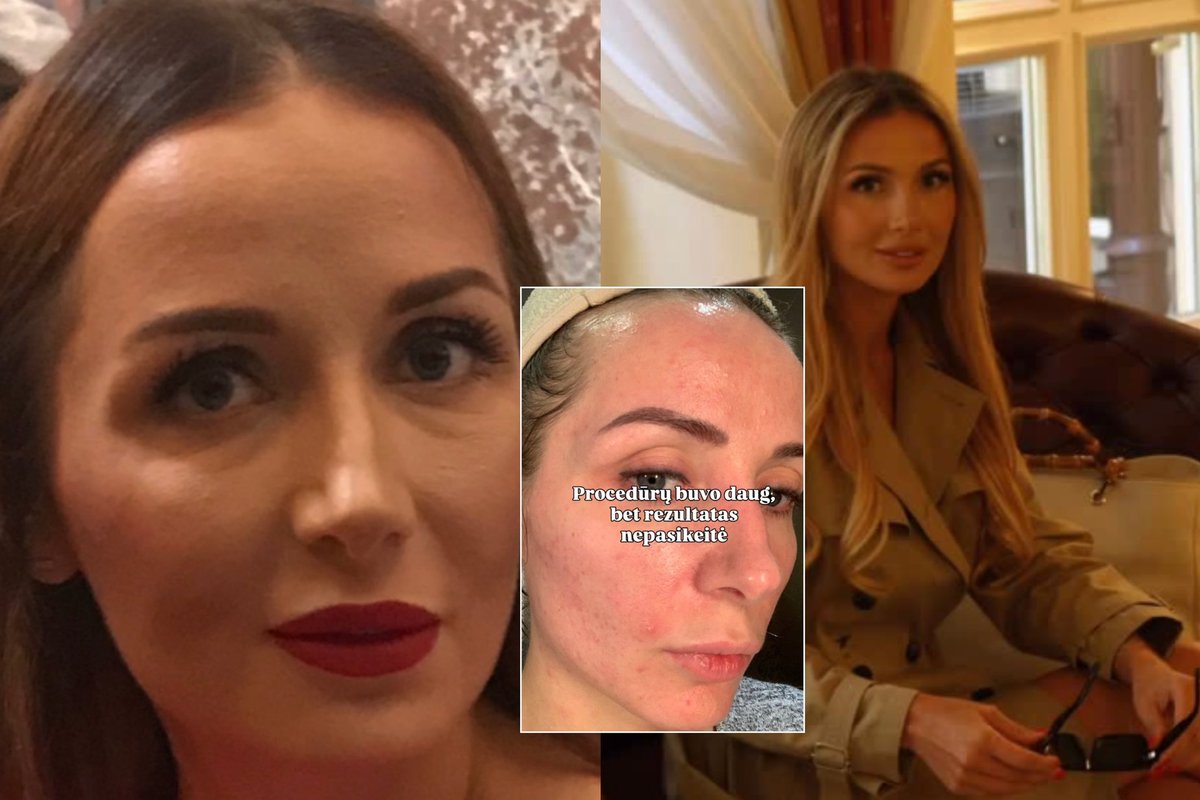 Pastabų dėl pasikeitusios išvaizdos sulaukianti Monika Ra atvira: jaučiu pareigą pasidalinti