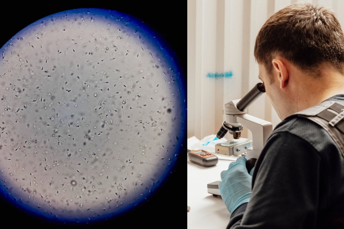 Spermos bankas pardavinėjo „mirtį sėjančią spermą“: šeimos įbaugintos dėl vaikų sveikatos - Delfi