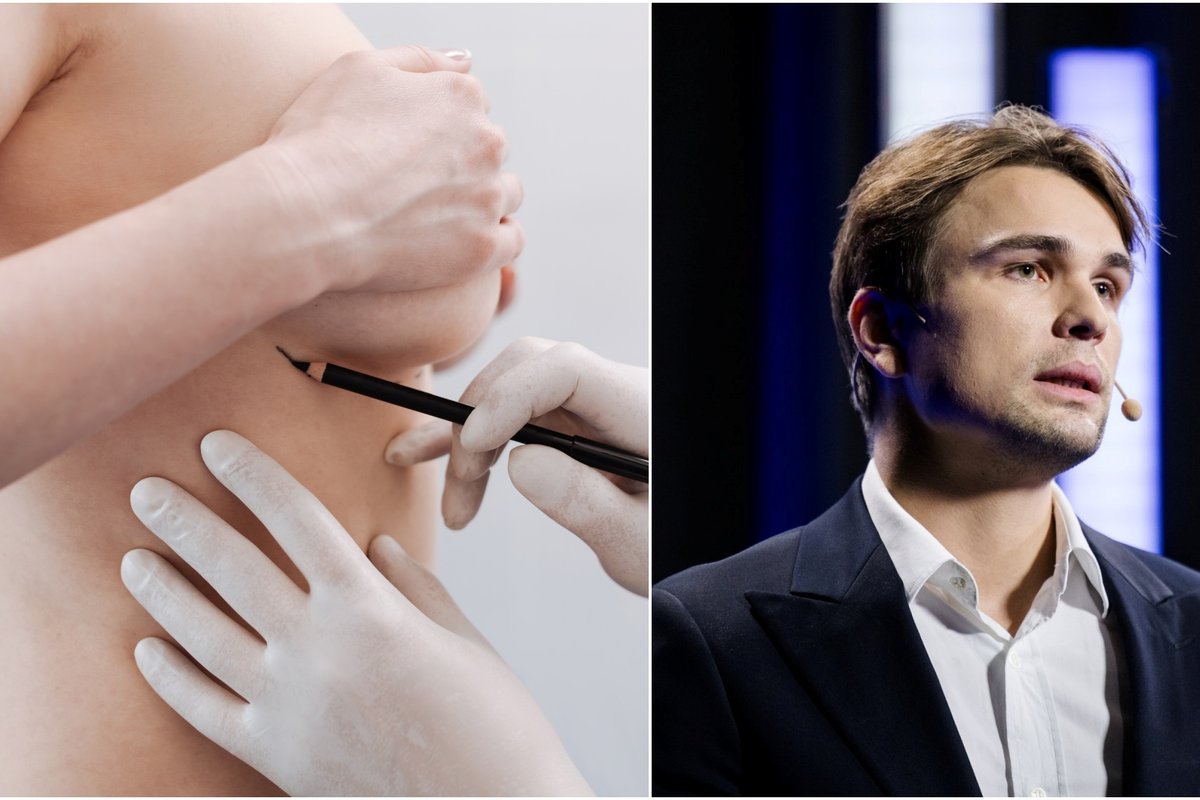 Populiarėja riebalų persodinimas į krūtis