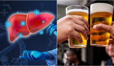 Padėkite atsigauti savo kepenims: atskleidė, ką reikia daryti