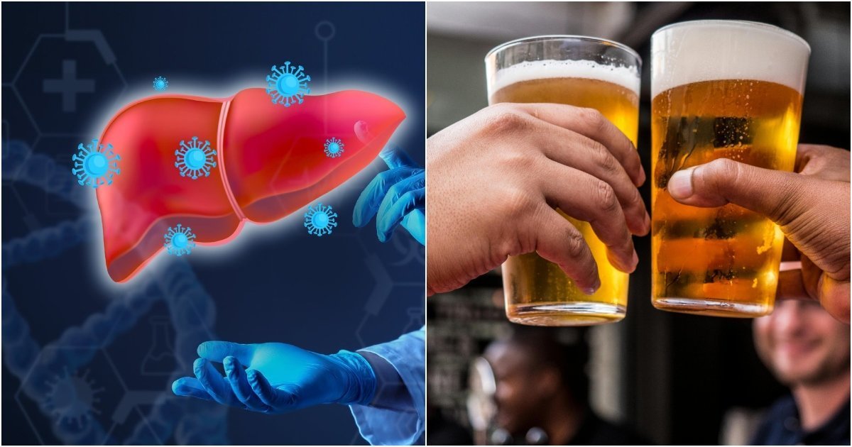 Padėkite atsigauti savo kepenims: atskleidė, ką reikia daryti