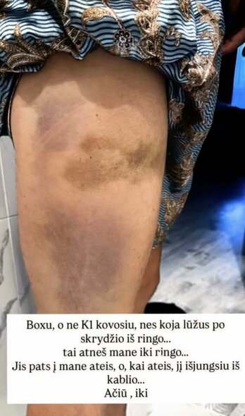 Dominykas Dirkstys | „Stop“ kadras Dominykas Dirkstys | „Stop“ kadras