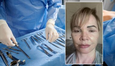 Užsienio žiniasklaidoje mirga Kauno vardas: škotė po plastinės operacijos gėdijasi išeiti į gatvę