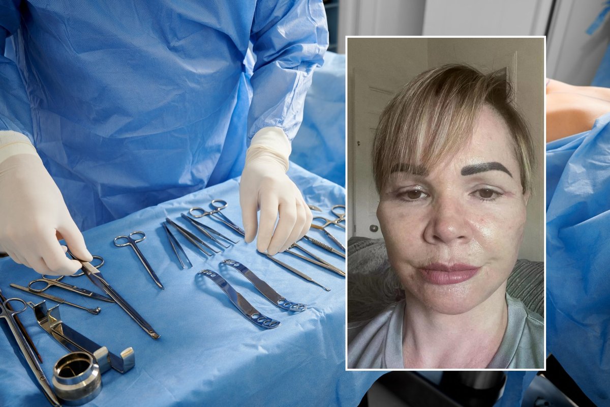 Užsienio žiniasklaidoje mirga Kauno vardas: škotė po plastinės operacijos gėdijasi išeiti į gatvę