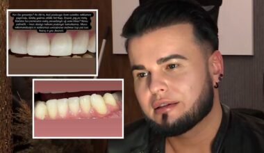 Vytenis Partikas pasipiktino odontologų darbu – parodė, kas po metų liko iš jo dantų