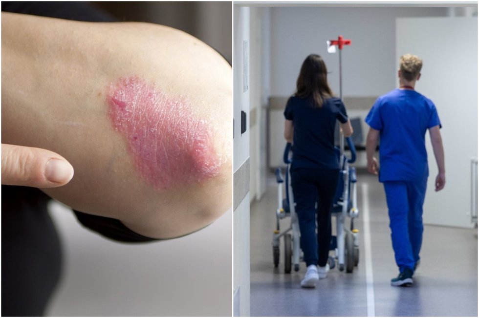 Žvynelinė (nuotr. ELTA) (tv3.lt koliažas)