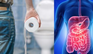 Kaip išvengti žarnyno infekcijų šventiniu laikotarpiu