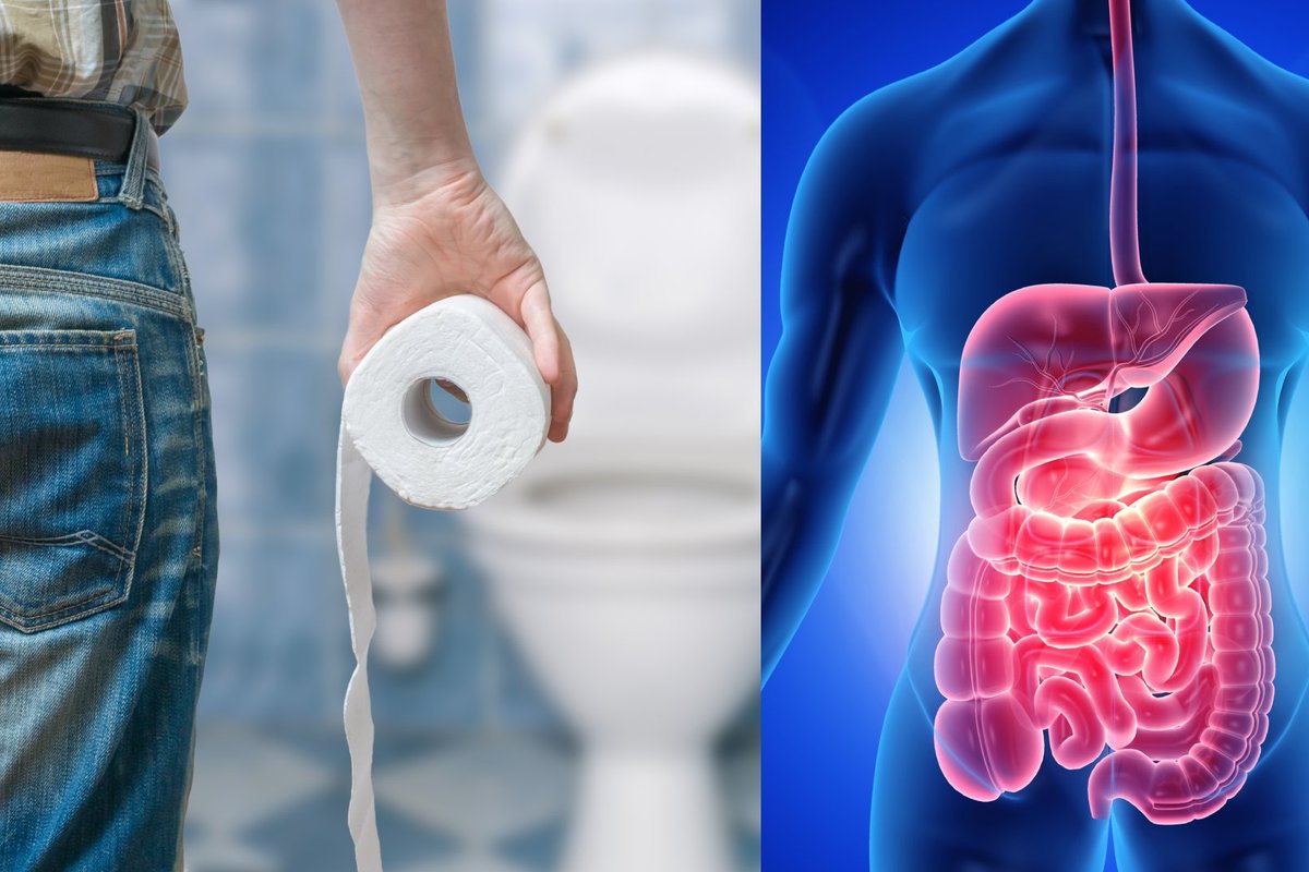 Kaip išvengti žarnyno infekcijų šventiniu laikotarpiu