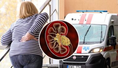 Medikai įspėja dėl tylaus pavojaus: ši liga dažna, tačiau aptinkama jau pažengusi – štai ką verta pastebėti