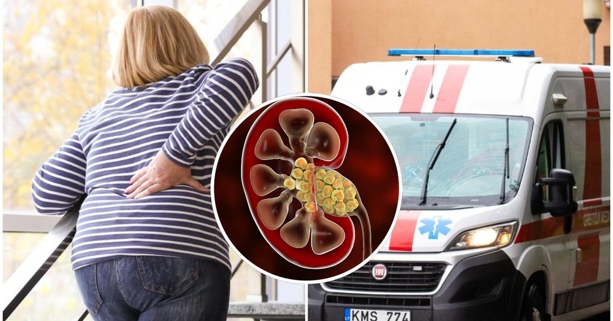 Medikai įspėja dėl tylaus pavojaus: ši liga dažna, tačiau aptinkama jau pažengusi – štai ką verta pastebėti