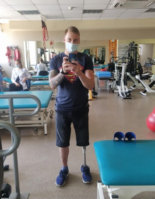 Karolis Švelnikas po kojos netekties (nuotr. asm. archyvo)