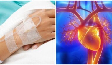 Medikai liko be žado: vyras mirė taip pat, kaip žmogus, kurio širdį nešiojo