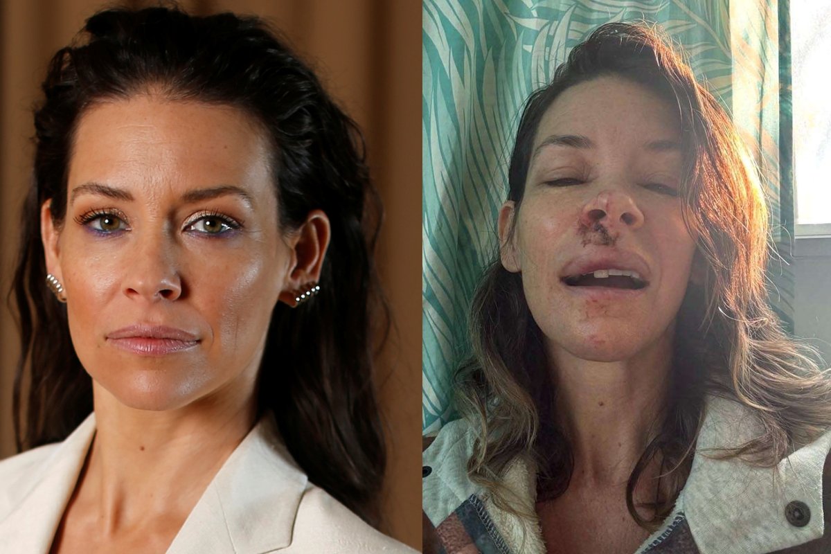 Nualpusi aktorė Evangeline Lilly trenkėsi į akmenį: iš medikų – liūdna žinia