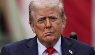 Trumpas prabilo apie savo sveikatą: pasisakė apie mėlynes ant rankų ir miegą per renginius