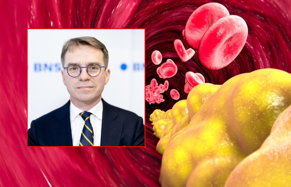 Grėsmė daugeliui lietuvių: ignoruoja šiuos simptomus, kol atsiduria per žingsnį nuo mirties (BNS nuotr.) (tv3.lt koliažas)