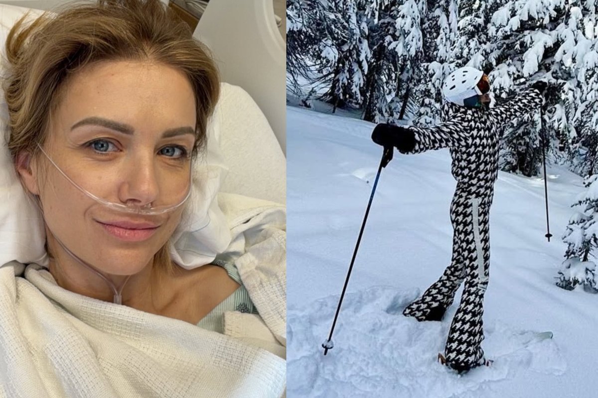 Modesta Vžesniauskaitė slidinėdama kalnuose patyrė traumą