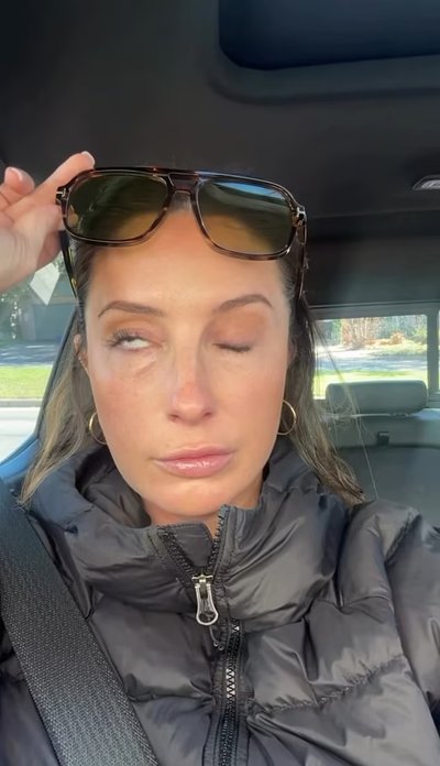 Garsios JAV politikės dukrai – veido paralyžius