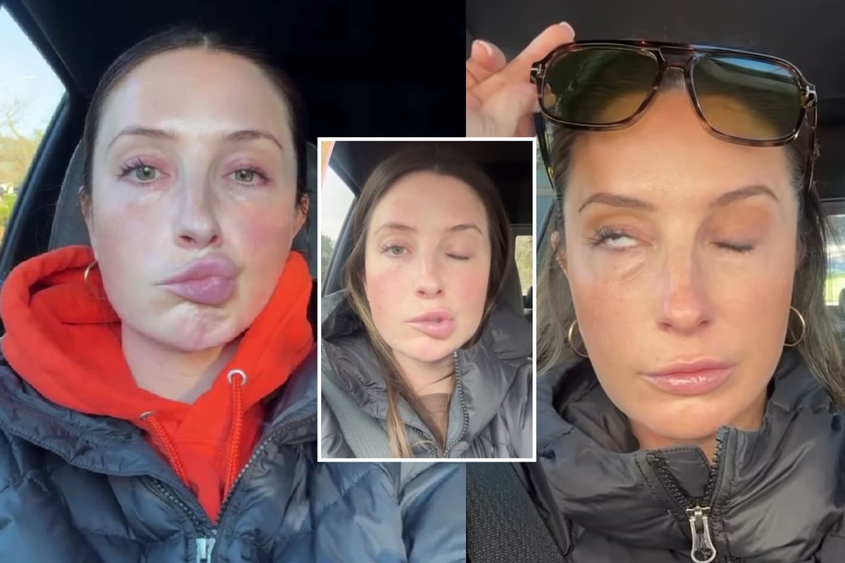 Garsios JAV politikės dukrai – šokiruojantis veido paralyžius