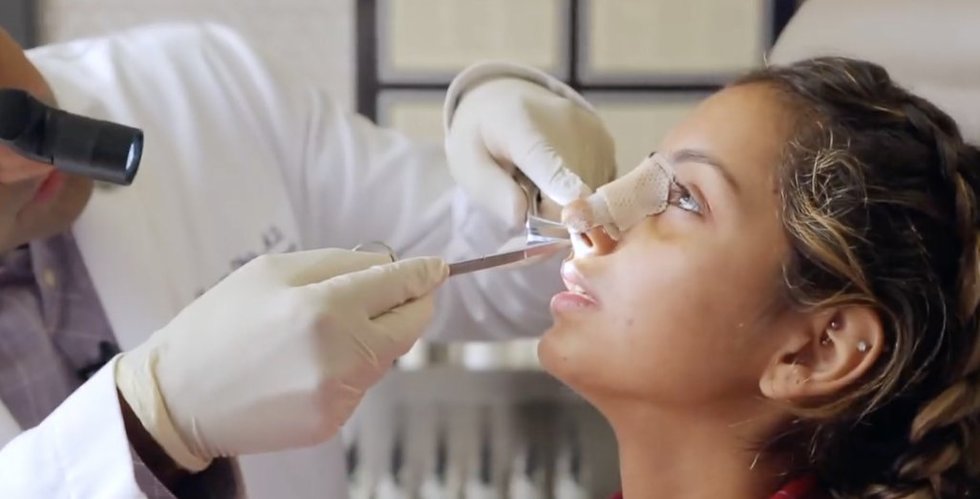 Lietuviai vis dažniau darosi plastines operacijas: atkeliauja ir interneto madų diktuojama ekstremalių operacijų mada (nuotr. stop kadras)