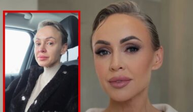 Rima Petrauskytė vos suvaldė emocijas – pranešė apie laukiančias 2 operacijas: „Sukryžiavusi pirštus laikau“ | Vardai