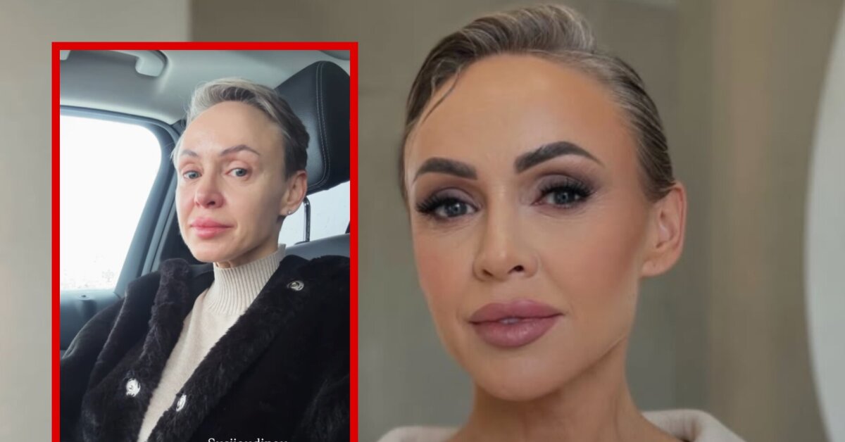 Rima Petrauskytė vos suvaldė emocijas – pranešė apie laukiančias 2 operacijas: „Sukryžiavusi pirštus laikau“ | Vardai