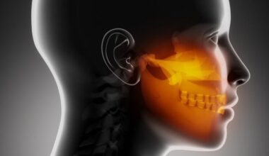 Burnos vėžį išduoti gali vos keli ženklai: ragina nenumoti ranka