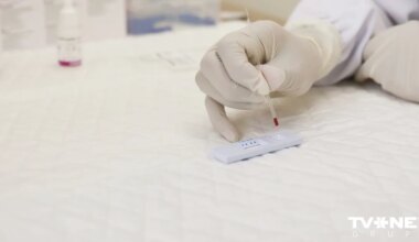 Bez maksas iespējams veikt HIV, B un C hepatīta, kā arī sifilisa eksprestestus