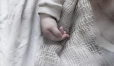 Zīdainis gūst letālus apdegumus slimnīcā; medmāsai izvirzītas apsūdzības