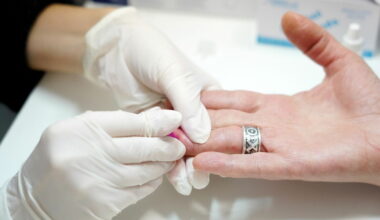 Foto: Zane Bitere/LETA