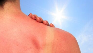 Rīgā notiks 20. Baltijas Dermatovenerologu asociācijas kongress