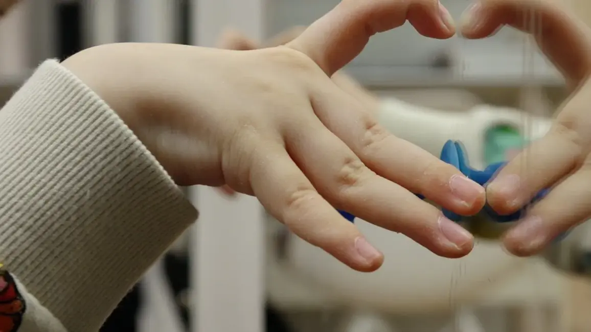 Ģimenes uzsver: Rehabilitācija bērniem ar kustību traucējumiem jānodrošina dzīvesvietas tuvumā, lai izvairītos no pārguruma un finansiālā sloga