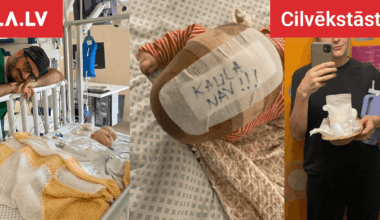 “Kaula nav!” Mamma Māra dalās sirsnīgā stāstā par meitiņas galvas operāciju četru mēnešu vecumā