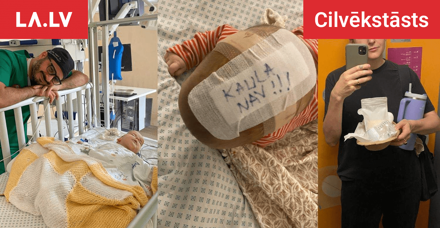 “Kaula nav!” Mamma Māra dalās sirsnīgā stāstā par meitiņas galvas operāciju četru mēnešu vecumā