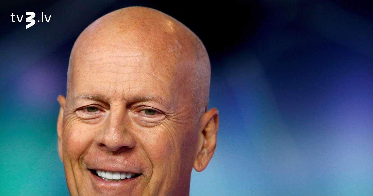 Ārzemju medijs: Brūsa Vilisa stāvoklis nenovēršami pasliktinās