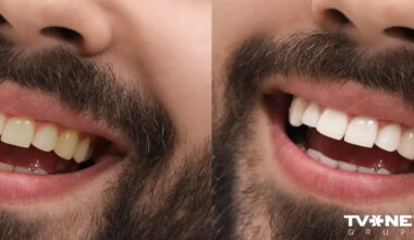 Cik veseli ir tavi zobi? Pētījumā atklāts, ka pēc mutes veselības var paredzēt priekšlaicīgu nāvi