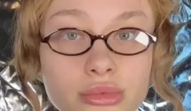 20 gadus vecā modele parāda, kā izskatījās pēc piedzīvotajām šausmām Dubaijā