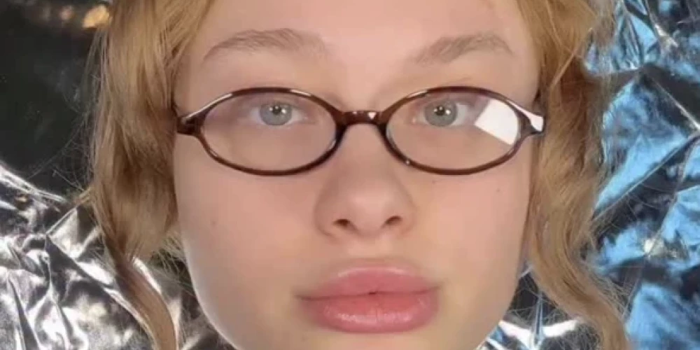 20 gadus vecā modele parāda, kā izskatījās pēc piedzīvotajām šausmām Dubaijā