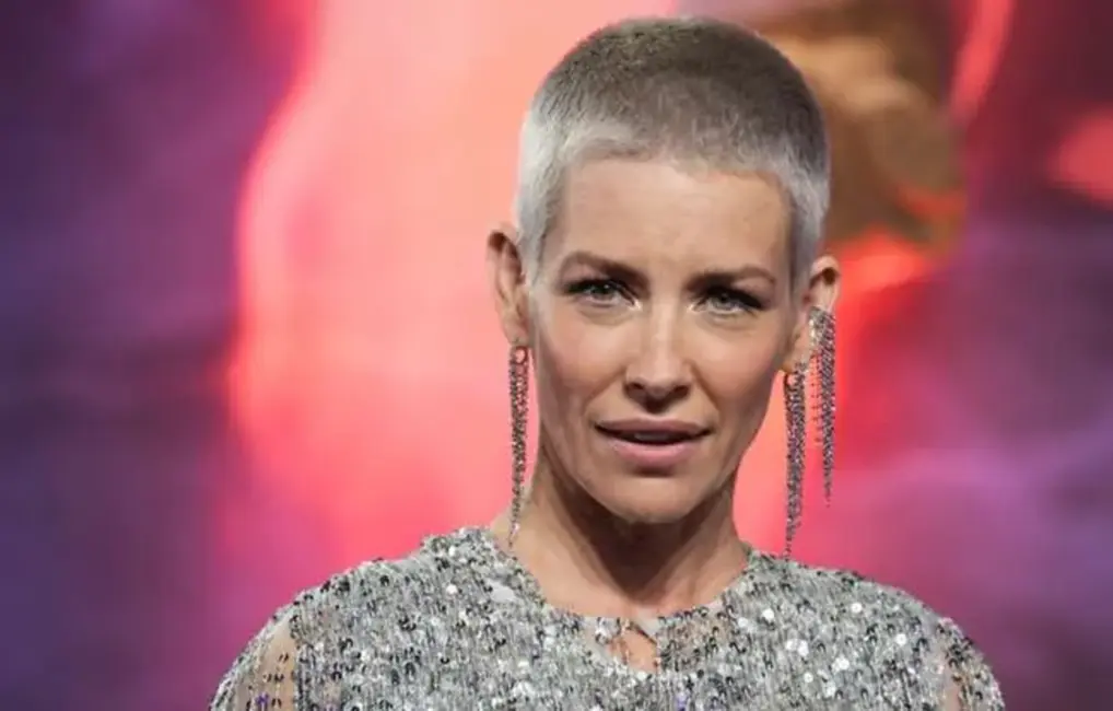 Hobita filmu zvaigznei Evandželīnai Lilī atklāti smadzeņu bojājumi