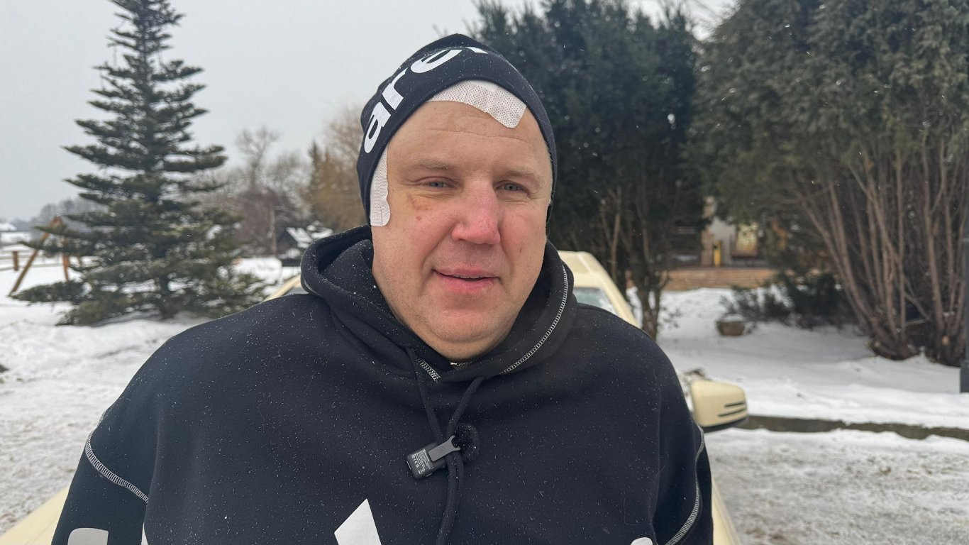 Retā operācijā Stradiņa slimnīcā caur galvaskausu izoperē audzēju acs dobumā / Raksts