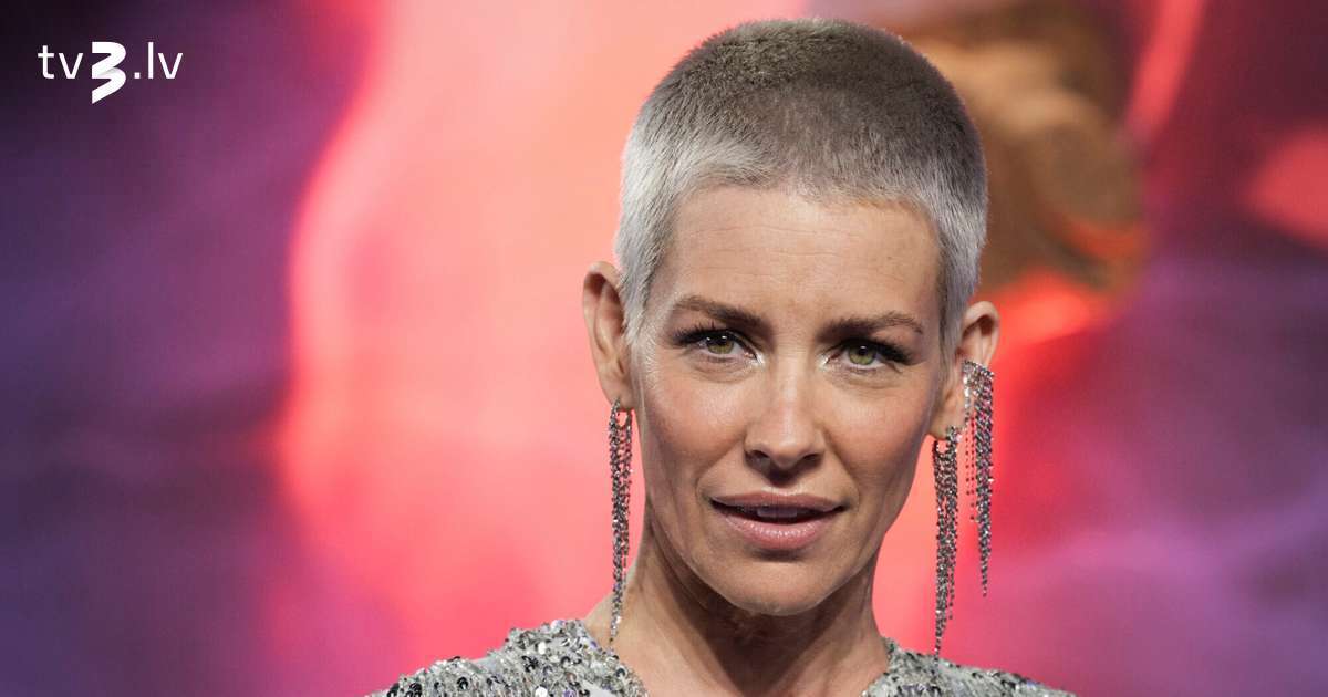 Hobita filmu zvaigznei Evandželīnai Lilī atklāti smadzeņu bojājumi
