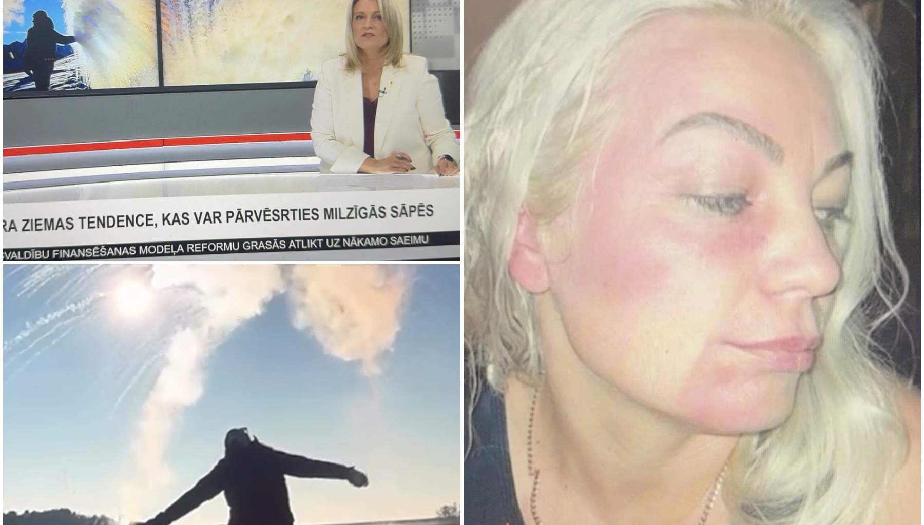 “Pat guļot vakar komā pamanīju” – TV3 sižets un Tālberga izpriecas sniegā samulsina vērīgākos skatītājus